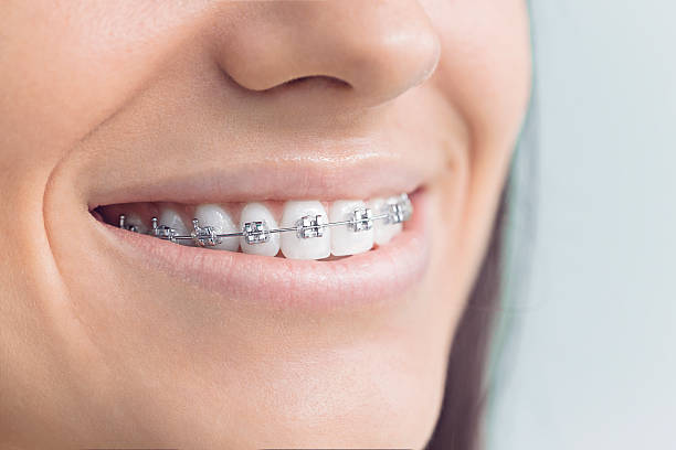 Why Choose Us for Your Dental Needs in Rossville, IL